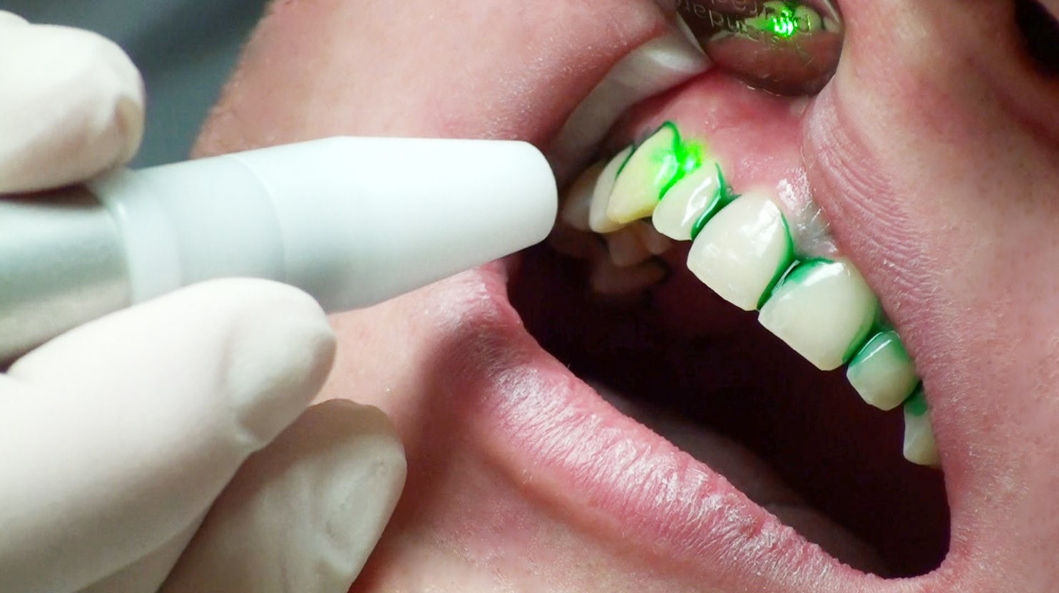 ganzheitliche Zahnheilkunde Dr. Heike Kretschmar - A.R.C. - Laser