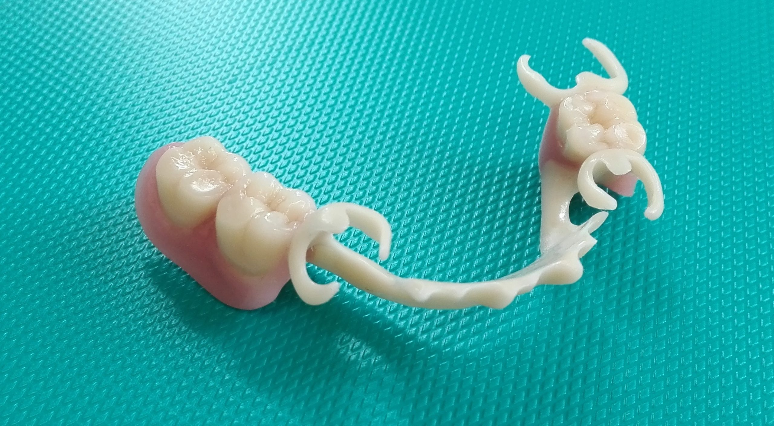 ganzheitliche Zahnheilkunde Dr. Heike Kretschmar - Zahnersatz mit Biocetalklammern